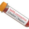 Test tube with blood sample positive SARS coronavirus, 3D rendering